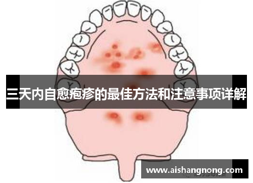 三天内自愈疱疹的最佳方法和注意事项详解