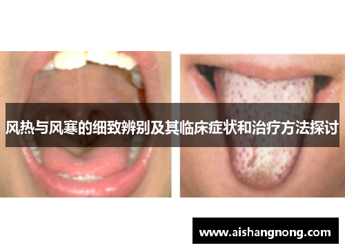 风热与风寒的细致辨别及其临床症状和治疗方法探讨